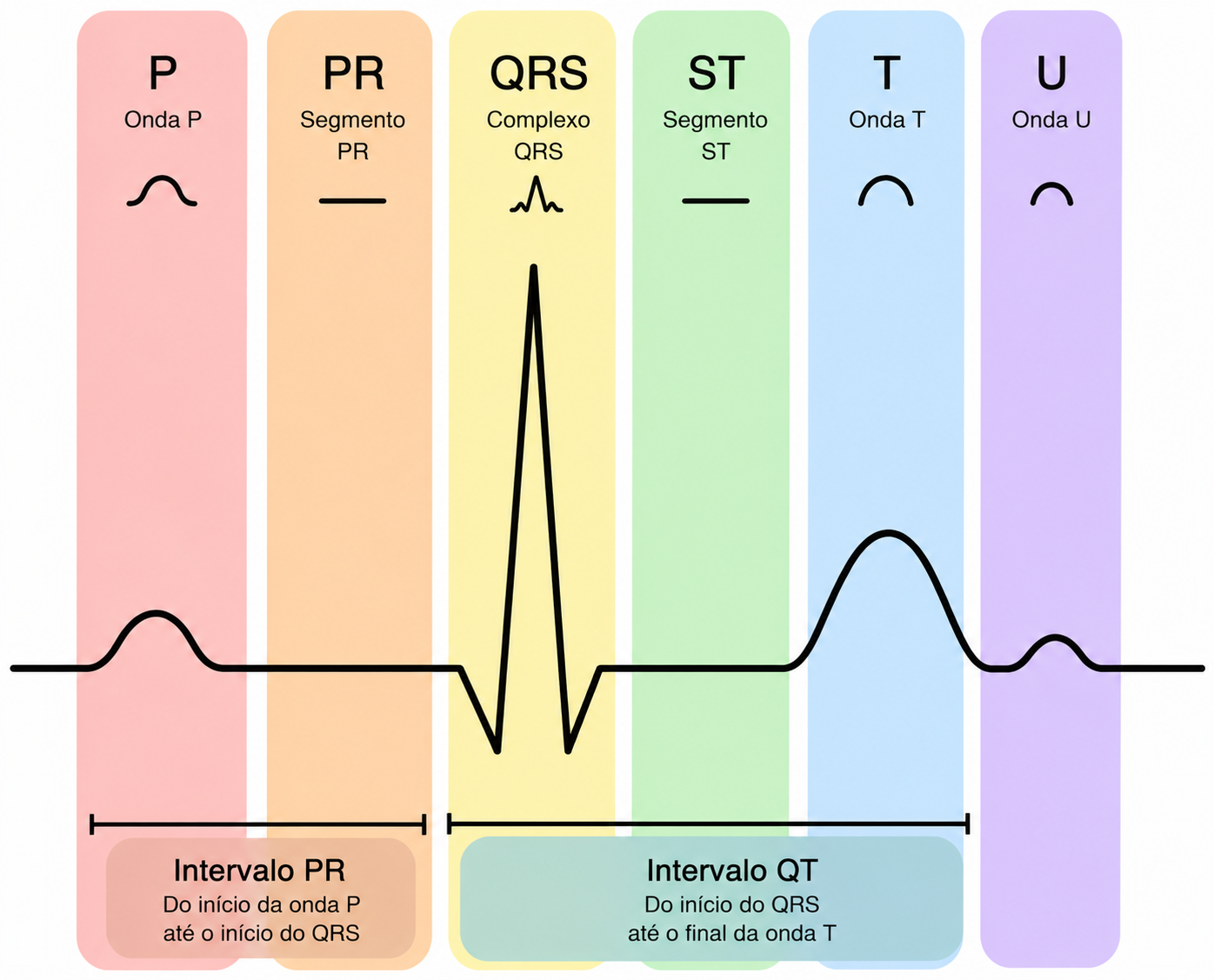 Diagrama das ondas do ECG